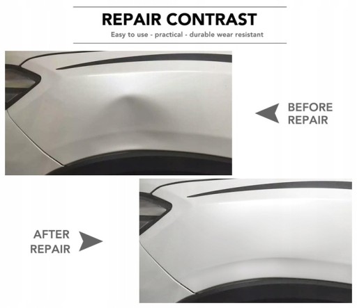 SET prísavka na extrakciu HAIL DENT REMOVAL