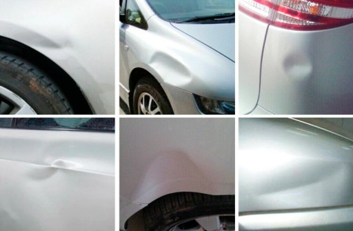 RÚČKA NA ODSTRAŇOVANIE PREDRUBKOV TELA DENTS POWER