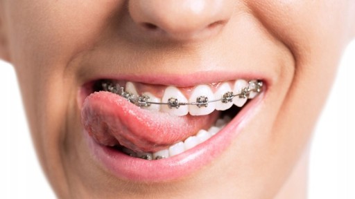 GUM Ortho ortodontická zubná pasta na strojčeky