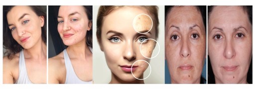 EXFOLIAČNÉ PLEŤOVÉ TONIKUM NA ODVETVENIE S DERMÉNOU KYSELINOU glykolovou