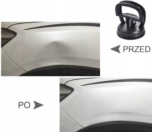 RUKOVÄŤ PRÍSAVKY NA ODSTRAŇOVANIE PREDUBENÍ TELA DENTS POWER WINCH