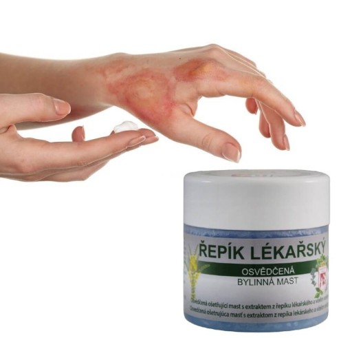 Masť na hemoroidy, repíkové bylinky, protizápalové, na praskliny, 150 ml Putorius