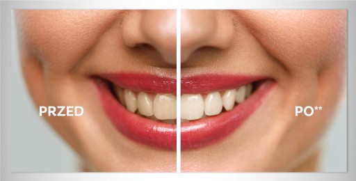 COLGATE Max White Ultra bieliaca pasta 50 ml + ZDARMA