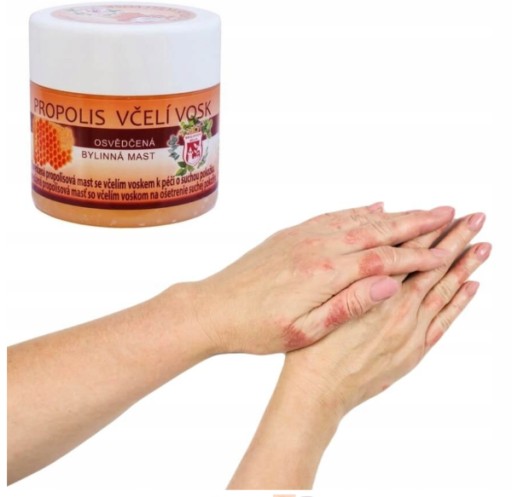 Propolisová masť s včelím voskom 150 ml