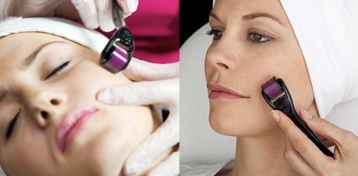DERMA ROLLER, HUSTÁ BRADA, MEZOTERAPIA, VLASY