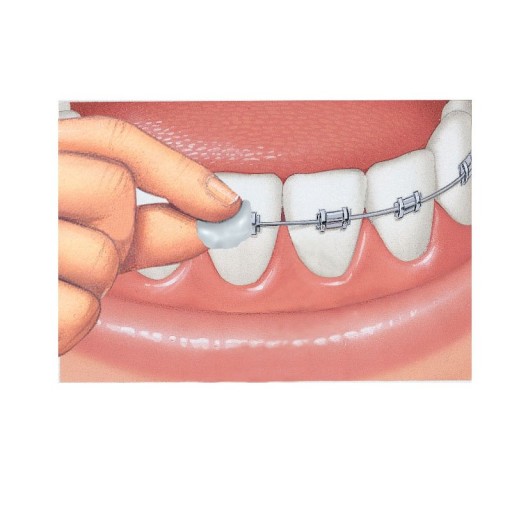 Chuťovo neutrálny ortodontický vosk GUM ORTHO Sunstar 1 ks