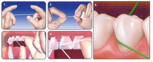 Gum Expanding Floss Zubná niť 1 kus